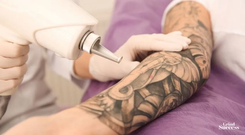 Unique tattoo removal company names ideas